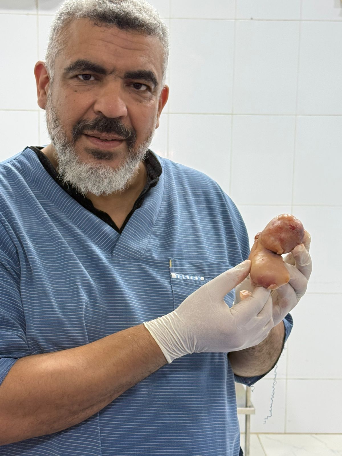 الدكتور هشام قاسم أستاذ جراحة الأطفال بكلية الطب بجامعة الزقازيق