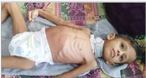 الطفل نائل شلبي