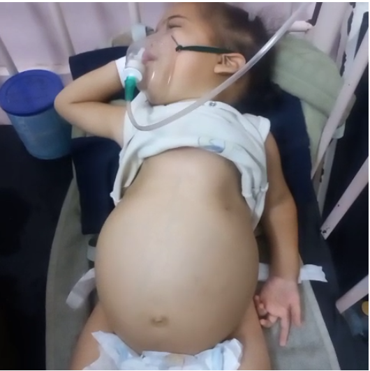 الطفلة الفلسطينية لانا زعرب بعد الإصابة