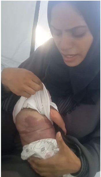 والدة الطفلة حبيبة أبورضوان