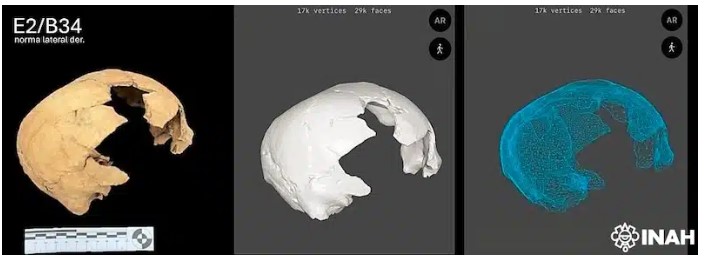 تعديل الجمجمة