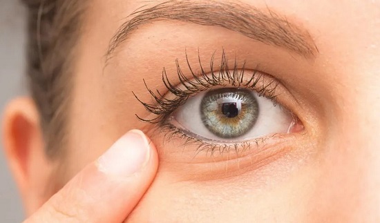 وصفات طبيعية للتخلص من تجاعيد العين وصفات طبيعية للتخلص من تجاعيد العين