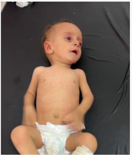 الرضيع الفلسطيني أنس أبو السعيد