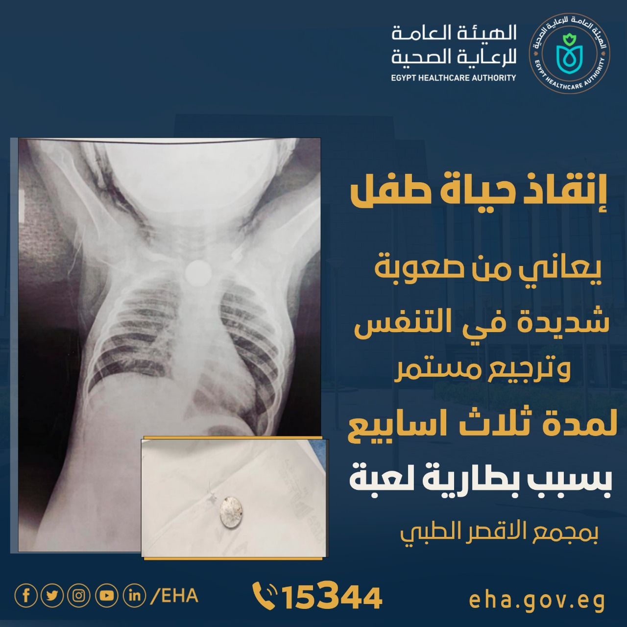 الرعاية الصحية بالأقصر تعلن إنقاذ طفل رضيع 10 شهور