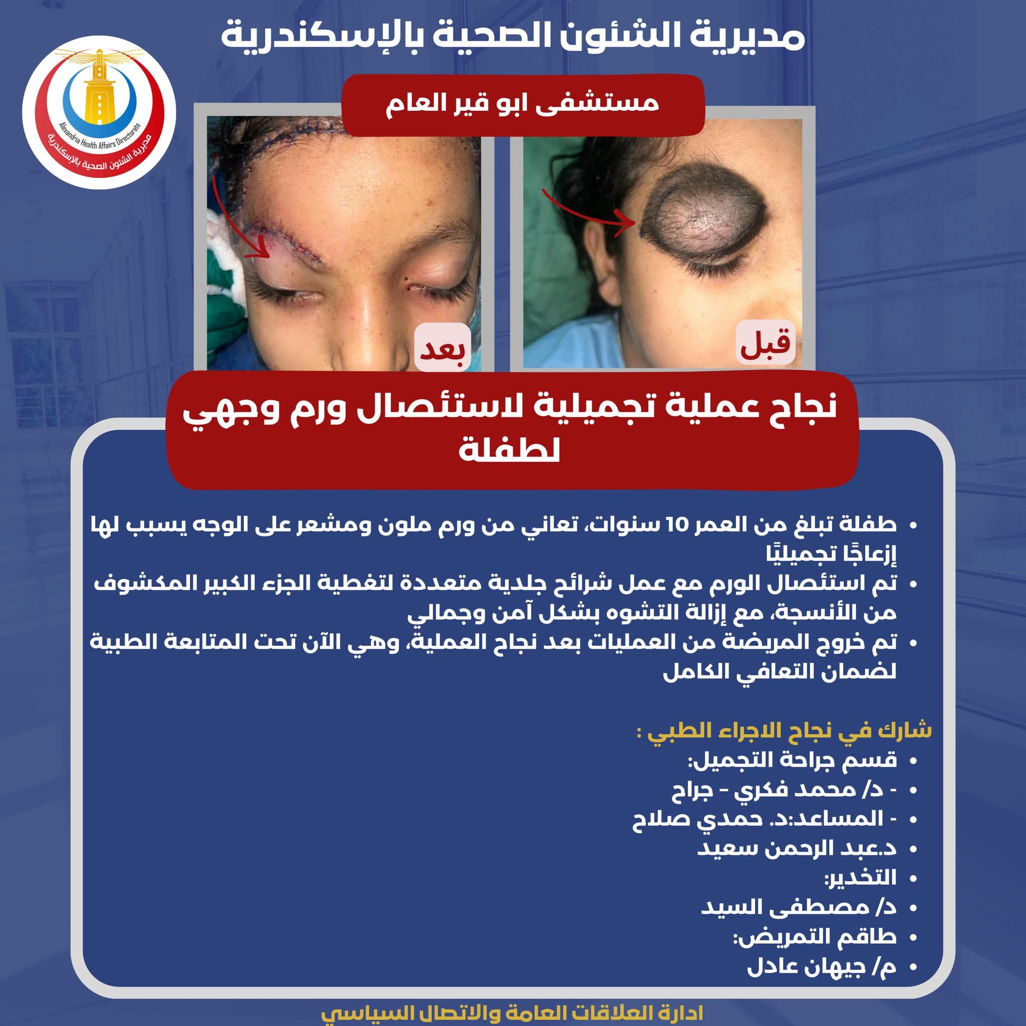 نجاح عمليه تجميليه لإزالة ورم ملون ومشعر من وجه طفله نجاح عمليه تجميليه لإزالة ورم ملون ومشعر من وجه طفله