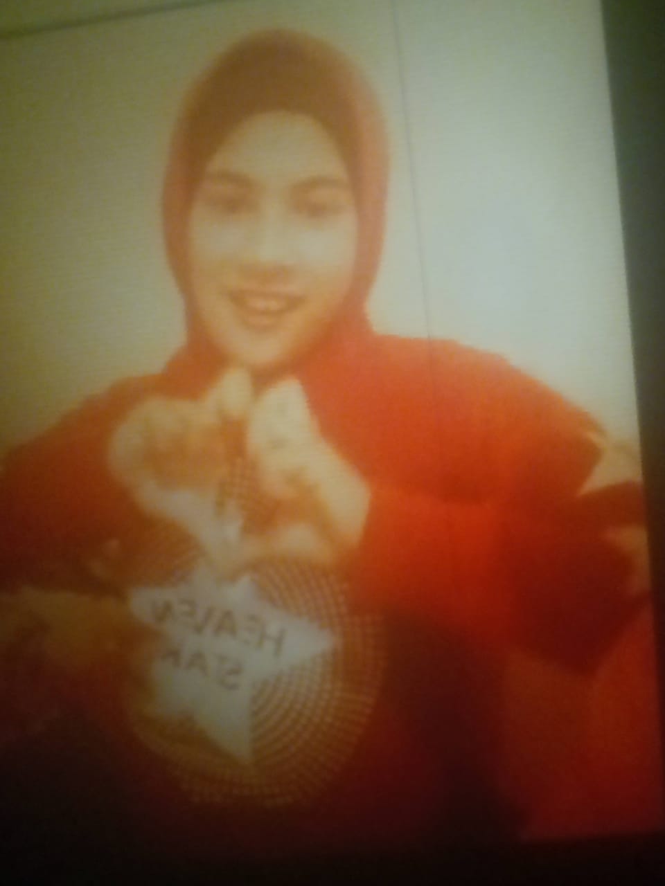 الطفلة ضحية تعذيب والدها