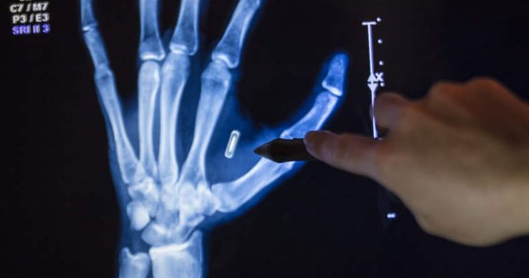 شريحة داخل جسم ساحر