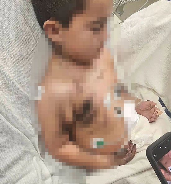 الشحن أثناء النوم.. نجاة طفل من صدمة كهربائية بسبب شاحن الهاتف