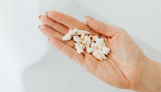 تفسير حلم فقدان الاسنان