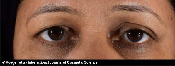 مشاركة أخرى 