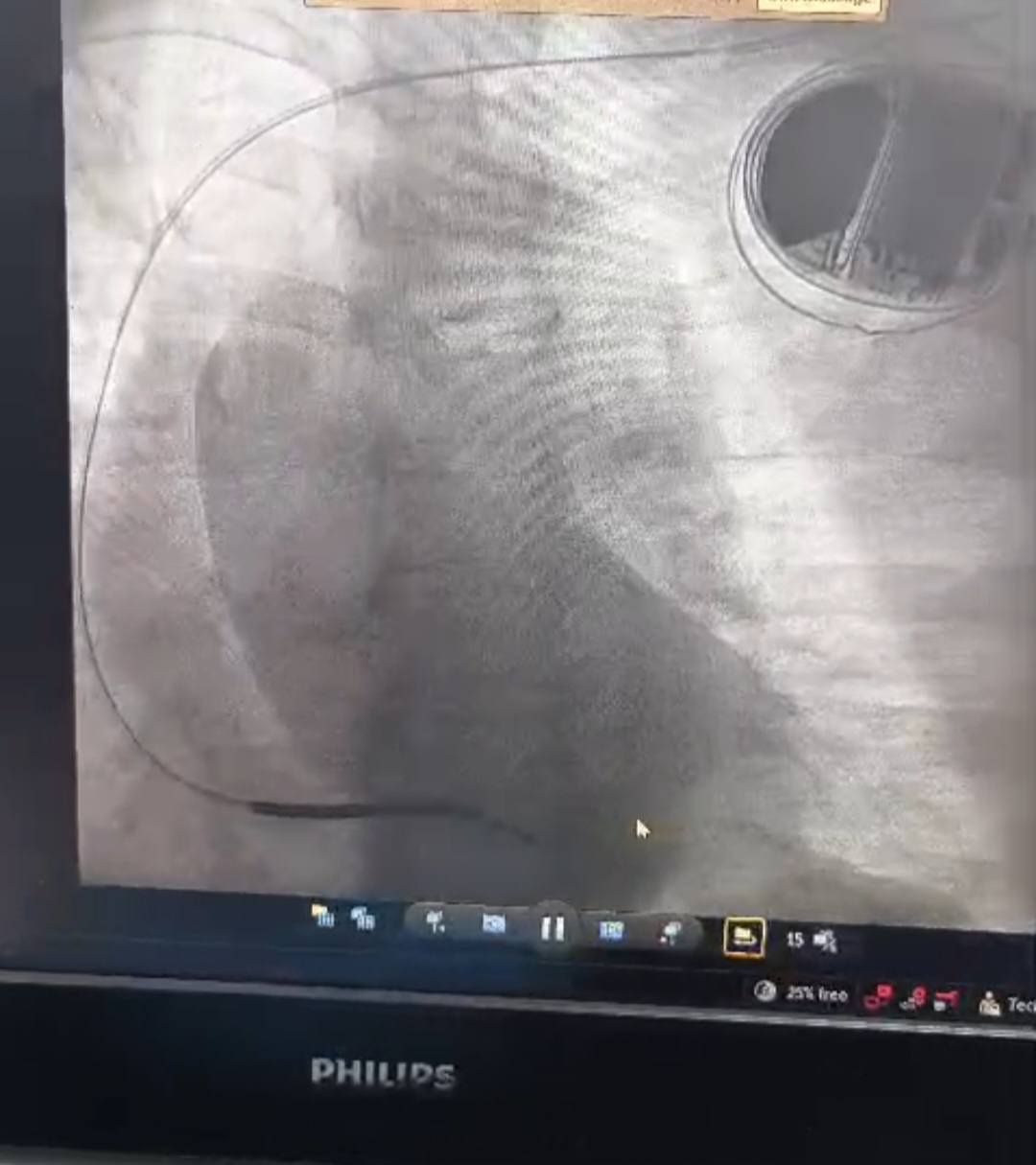 صورة لأشعة المريض صورة لأشعة المريض