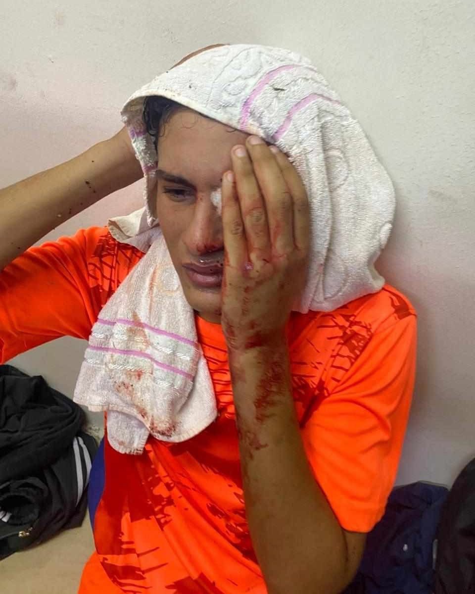 لاعب أبو قير المصاب لاعب أبو قير المصاب