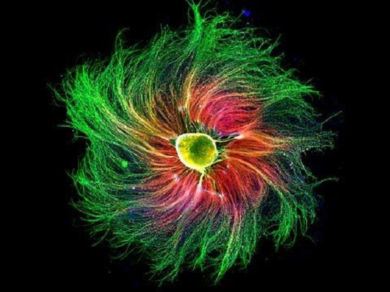 جائزة اغرب تصوير مجهري