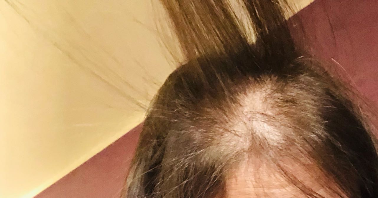 حالة رحمه حسن الصحية حالة رحمه حسن الصحية