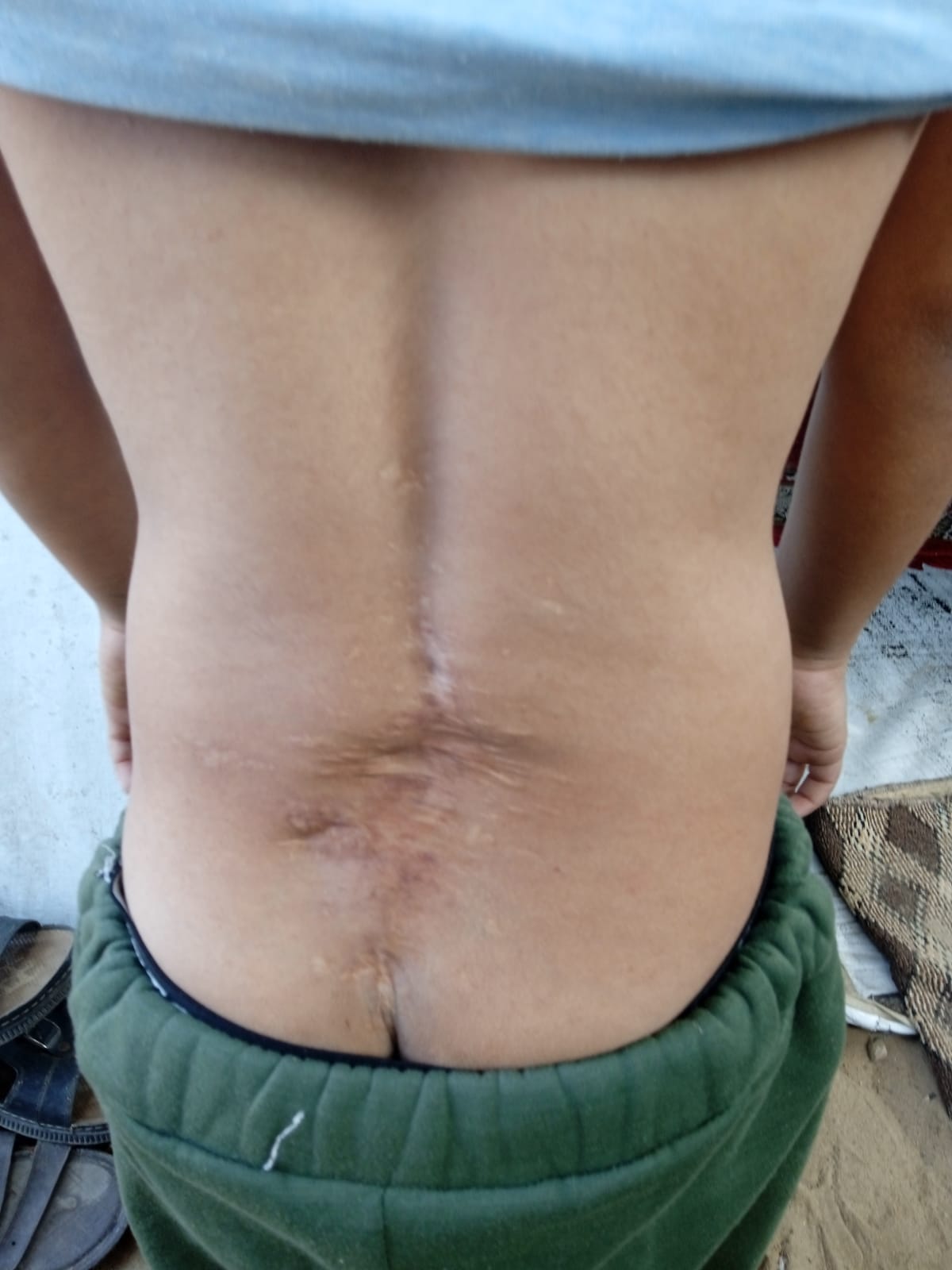 إصابة الطفل إبراهيم الشاعر