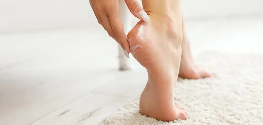 ترطيب الكعبيين فى الشتاء ترطيب الكعبيين فى الشتاء