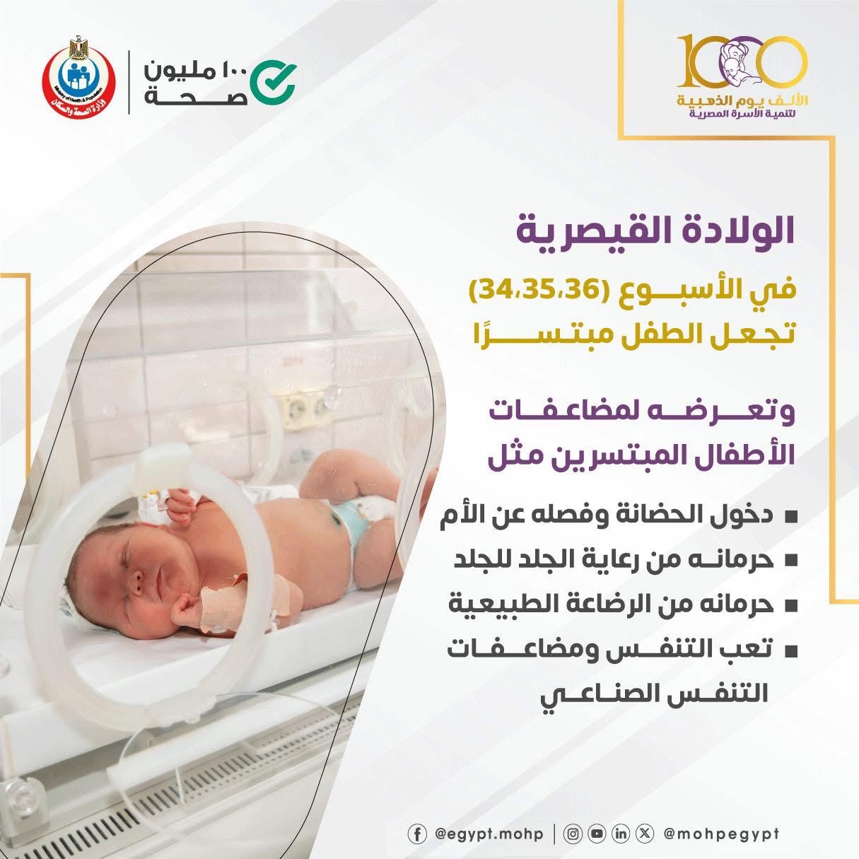 الولادة القيصرية الولادة القيصرية