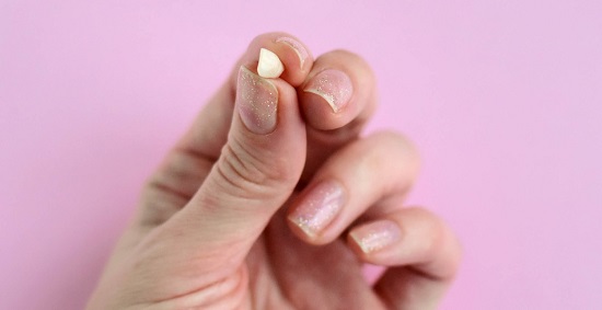 خلع السن خلع السن