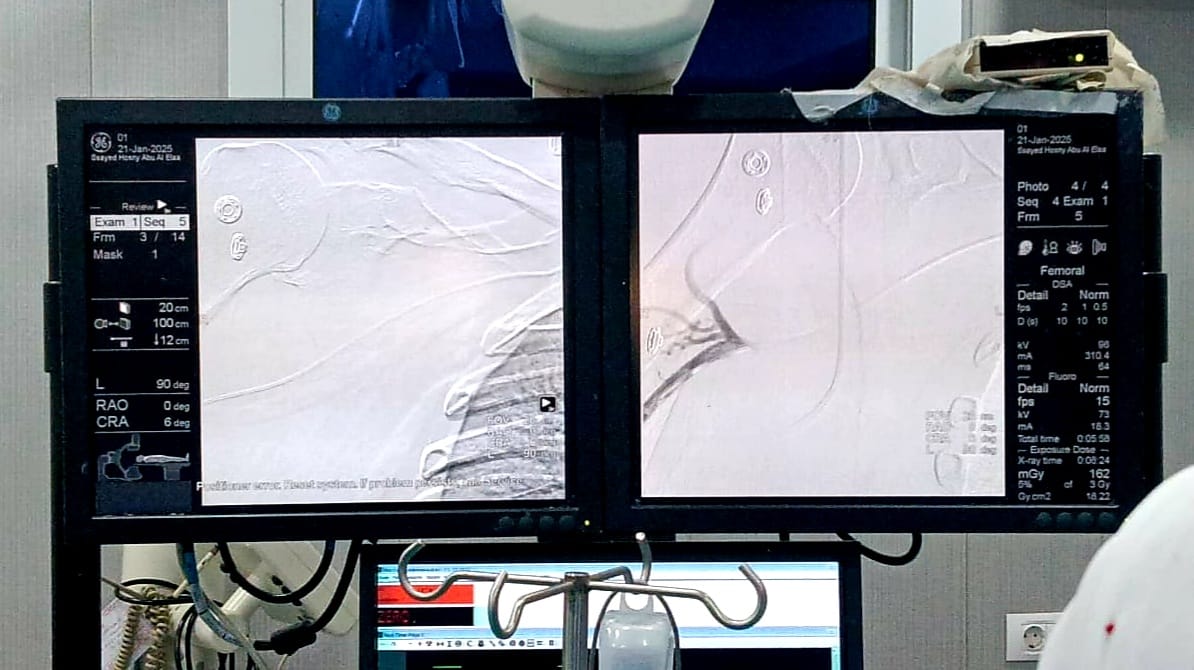 أجهزة القسطرة التداخلية بالمستشفى