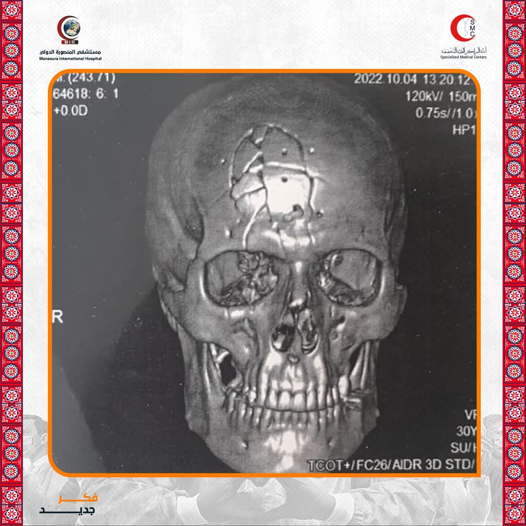 أشعة المريض