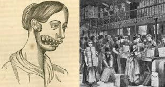 صانعوا اعواد الثقاب