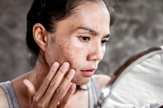 تفتيح البشرة تفتيح البشرة