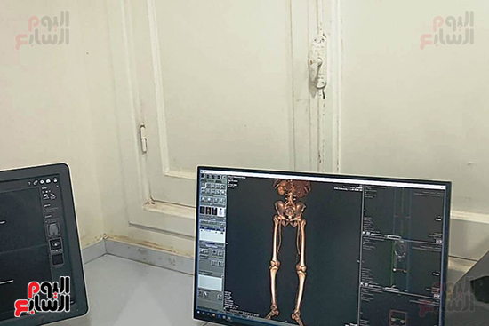 صورة-الأشعة-بالقسم