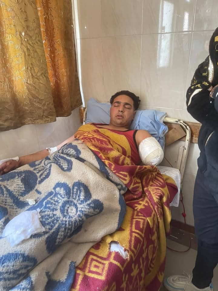 عامل السيرك عامل السيرك