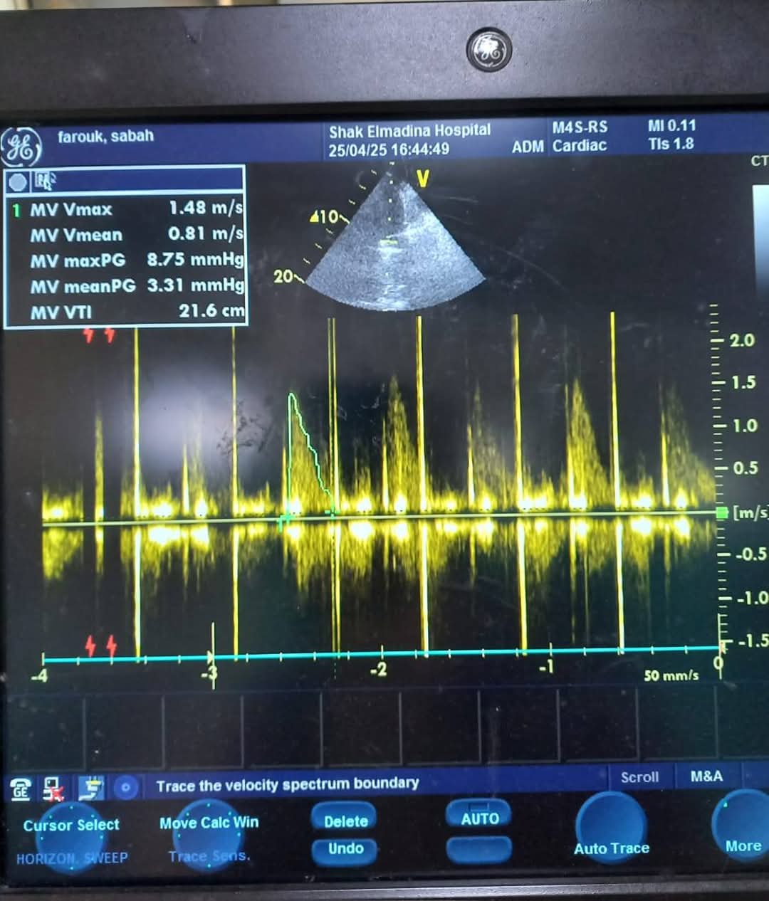 إنقاذ حياة مسنة في الإسكندرية