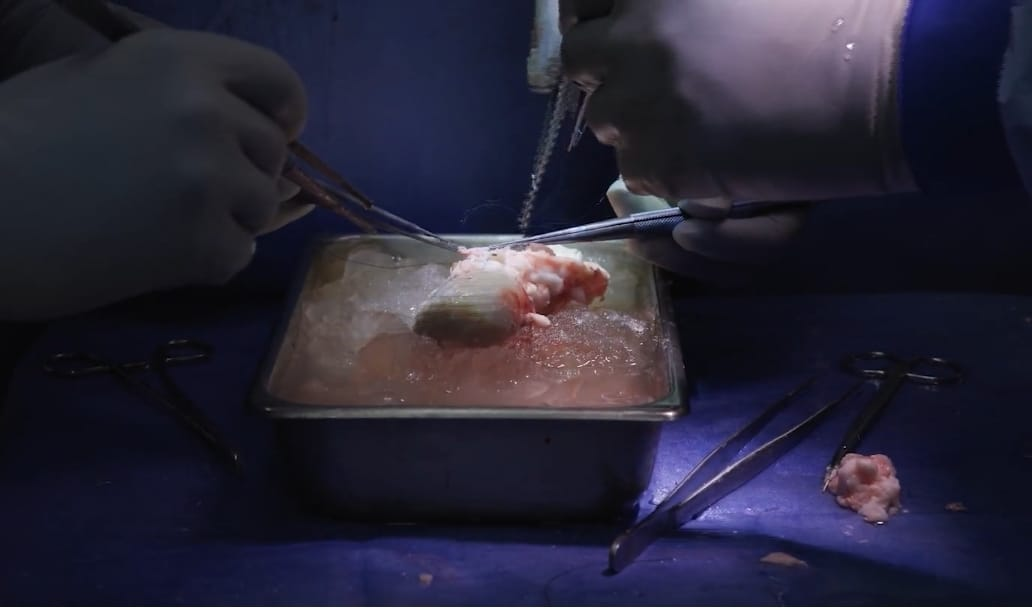 كلية الخنزير