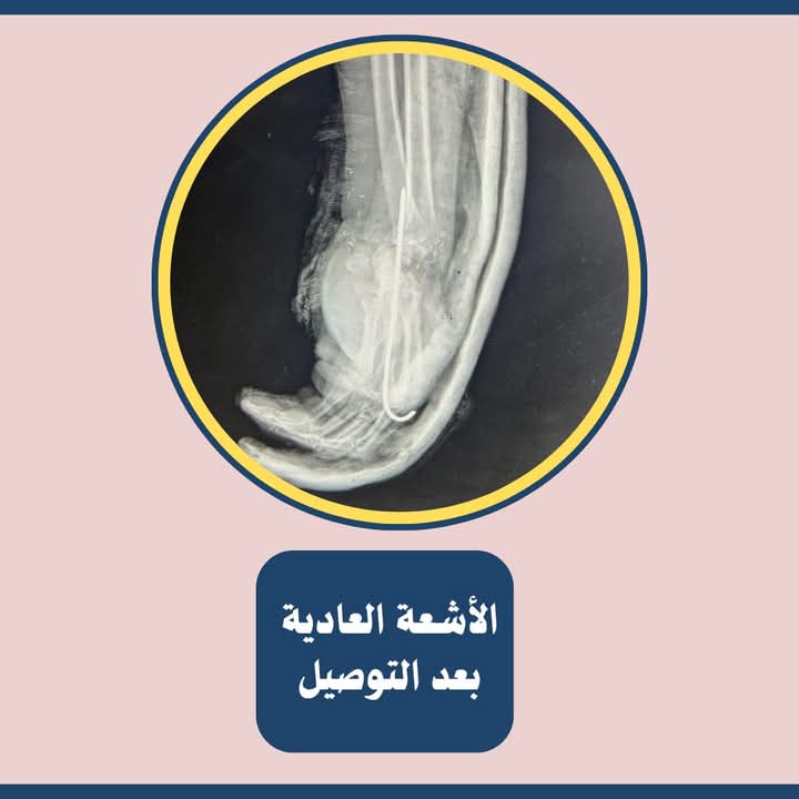 الاشعة العادية بعد التوصيل الاشعة العادية بعد التوصيل