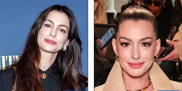 آنا هاثاواي قبل وبعد التجميل آنا هاثاواي