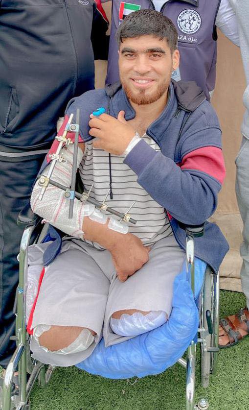 أحمد ابو محسن بعد بتر قدميه نتيجة الإصابة أحمد ابو محسن بعد بتر قدميه نتيجة الإصابة