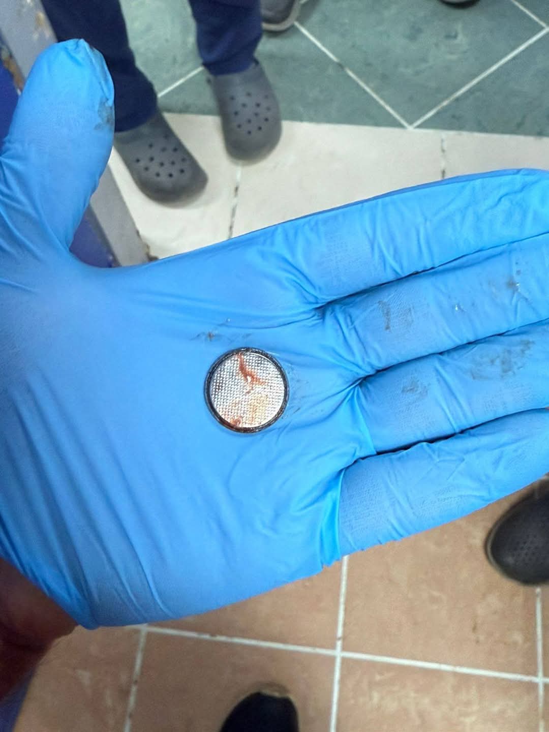 الحجر بعد استخراجه