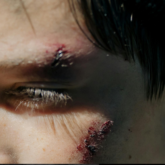 تفسير حلم الدم