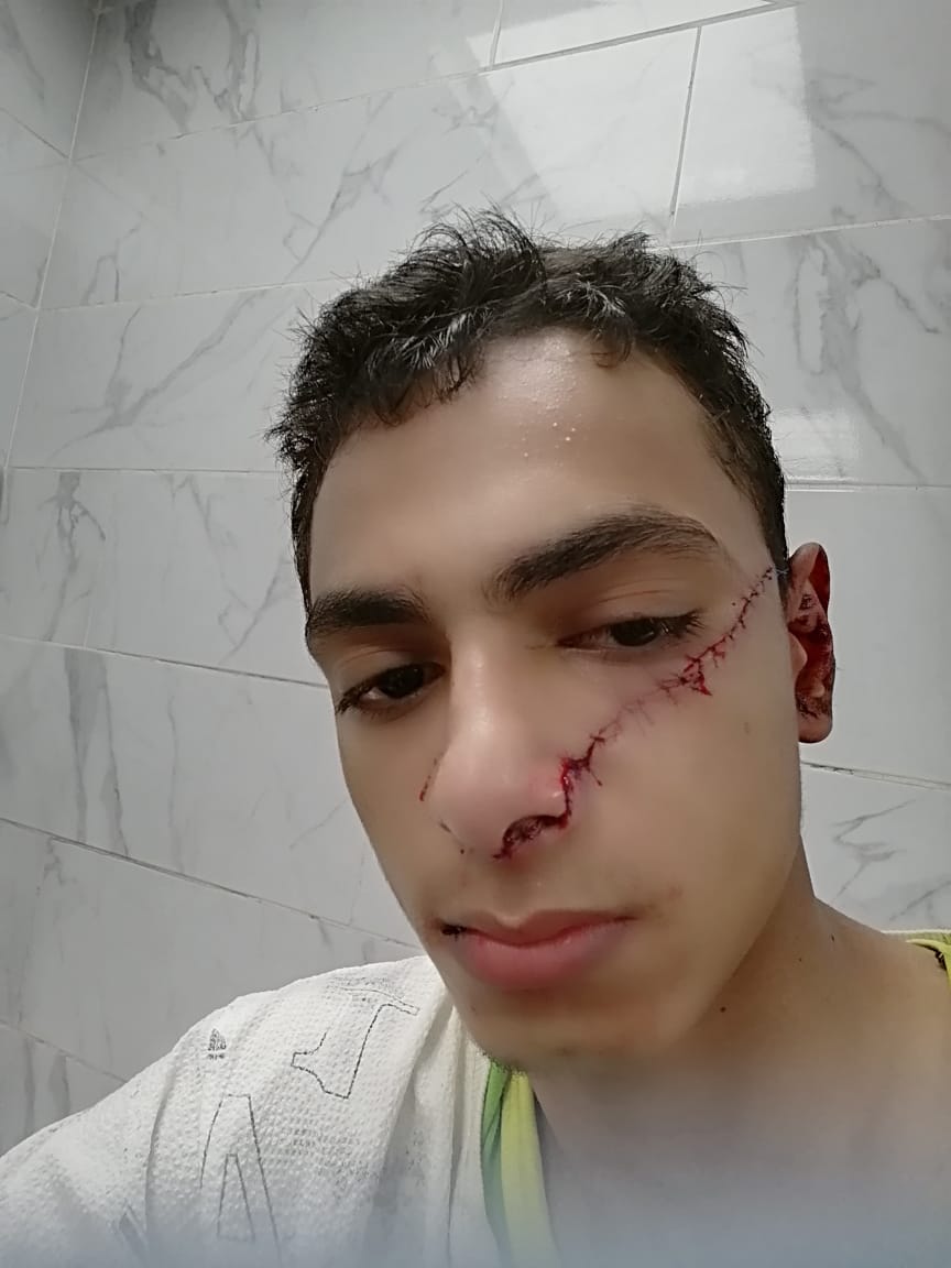 المجنى عليه (1)