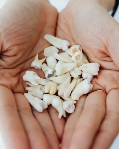 تفسير حلم سقوط الاسنان