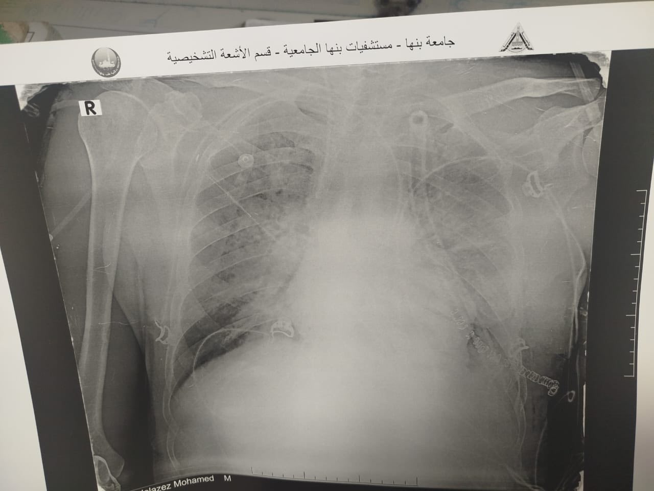 الأشعة الخاصة بالمريض