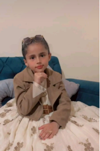 لانا الشريف قبل إصابتها بالبهاق
