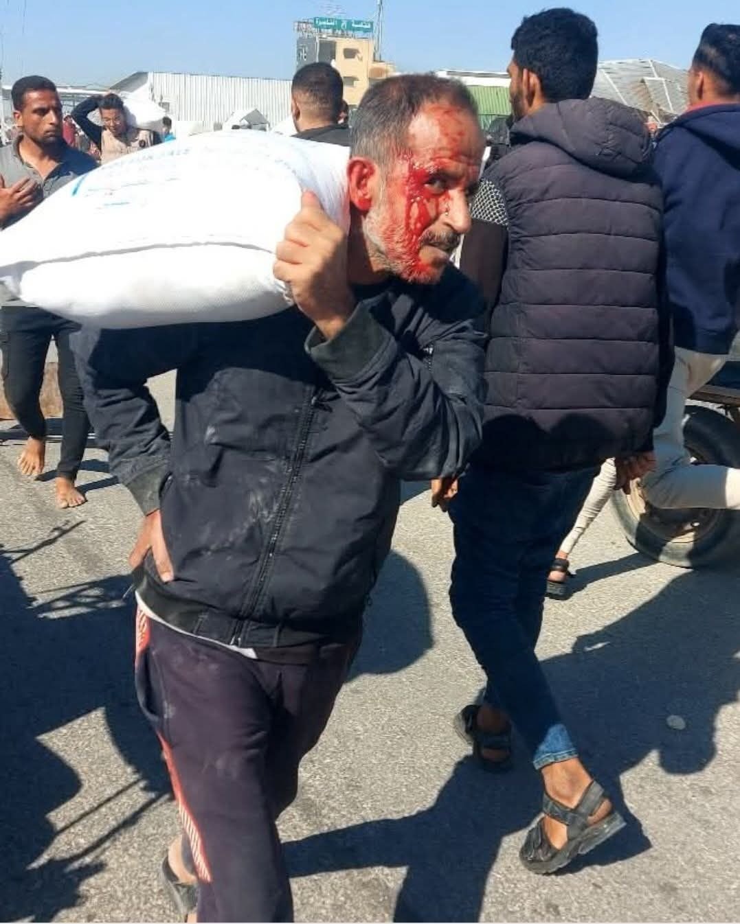 مواطن فلسطيني مصاب خلال محاولته الحصول على المساعدات