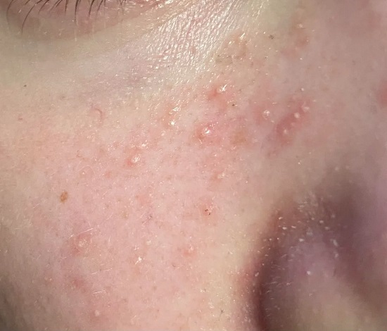 البامب سكين