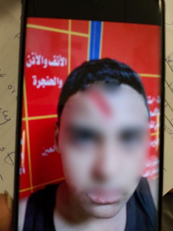المجنى علية (2)