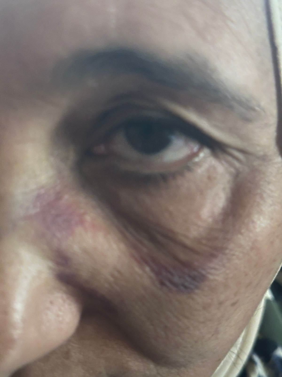 واقعة ضرب طبيبة بالمنصورة