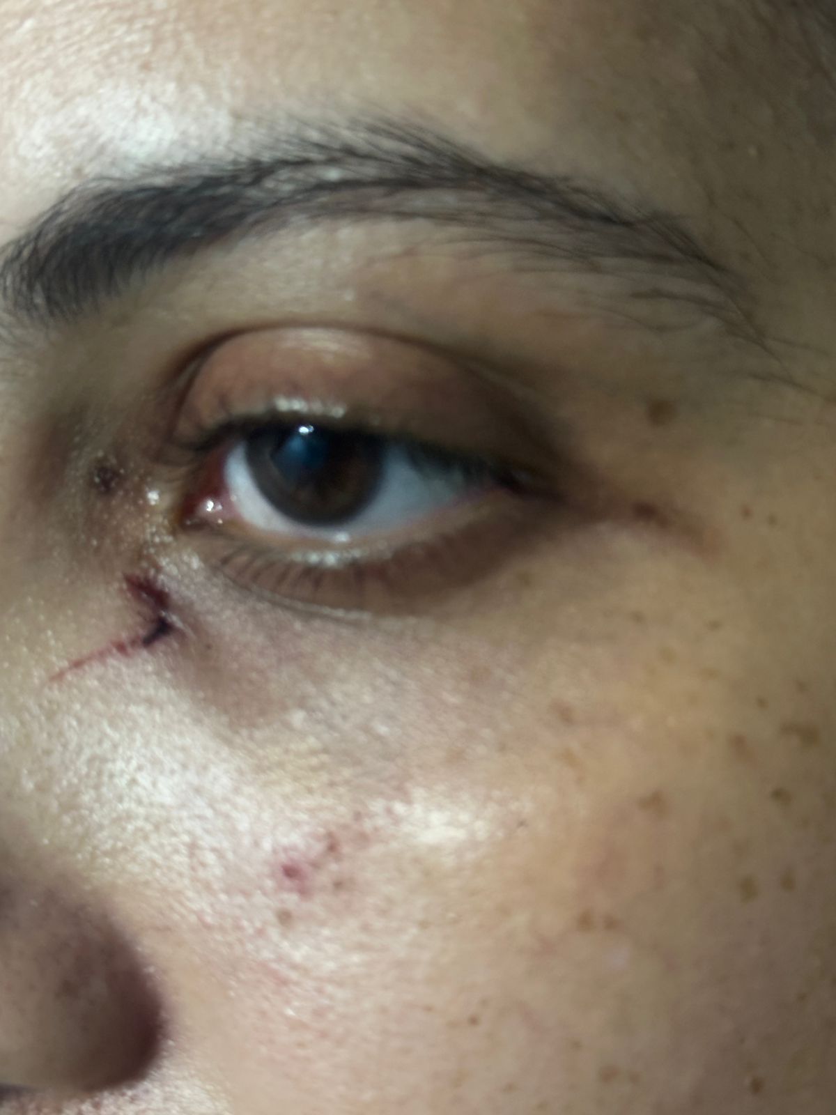 مستأجر يتعدى بالضرب