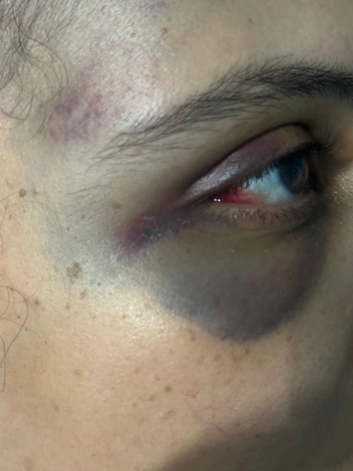 ضرب طبيبة على يد مستأجر