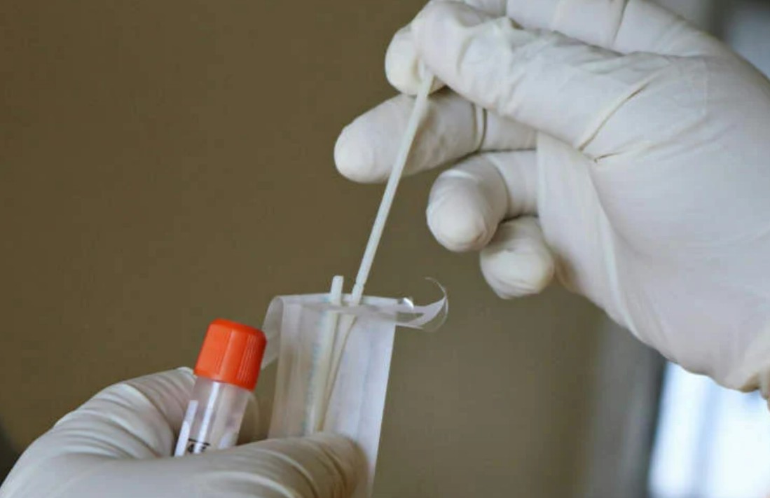 تحليل حمض نووي