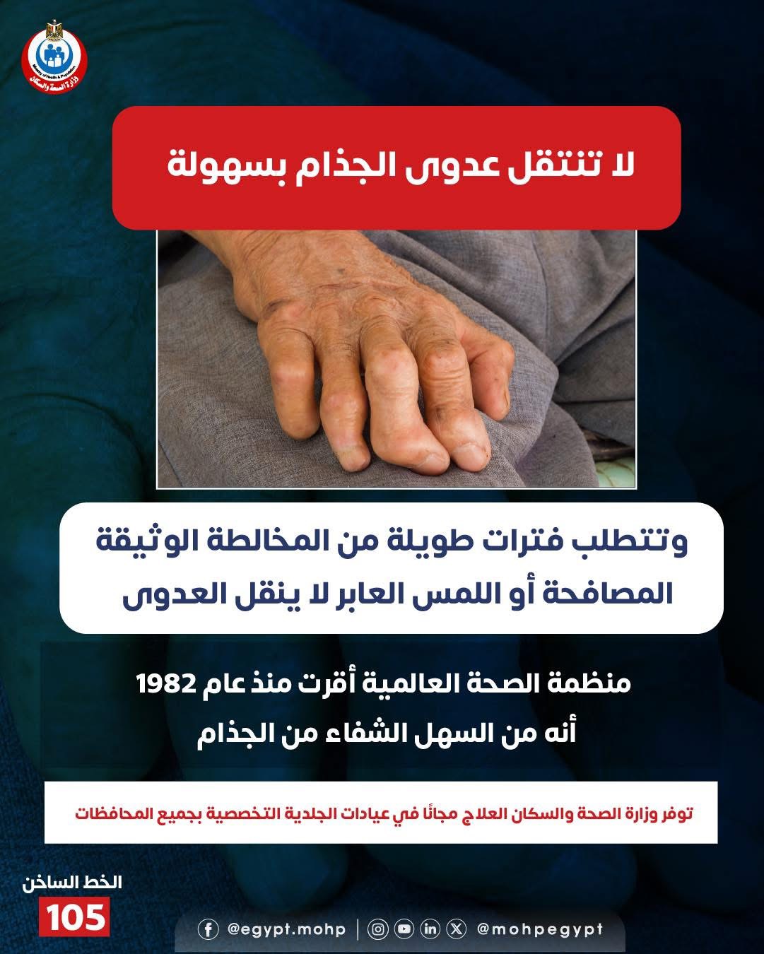 عدوى الجذام لا تنتقل بسهولة