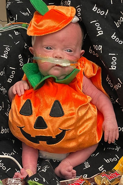 nash-keen-most-premature-baby-dressed-as-pumpkin-for-first-halloween-aged-three-months