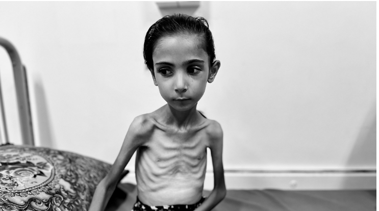 الطفلة آمال البيوك
