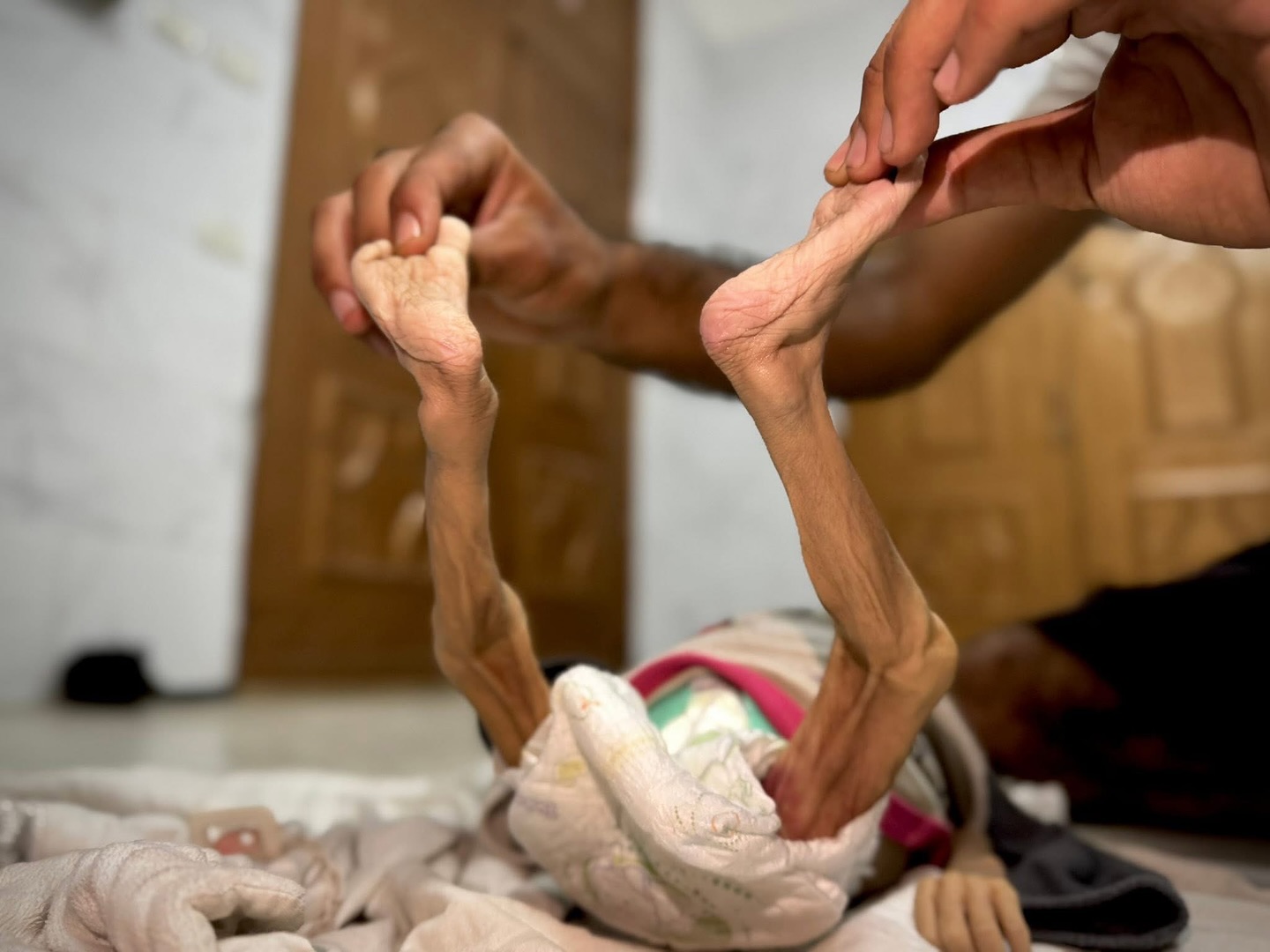 الرضيعة الفلسطينية زينب ماتت من الجوع
